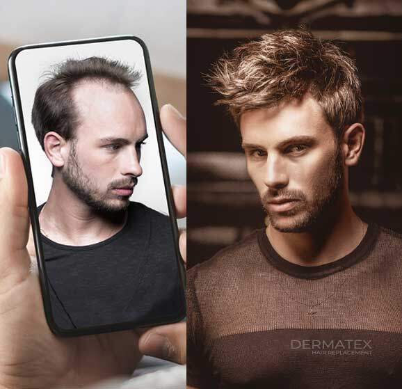 men8 mens hair loss solutions Laguna Hills CA